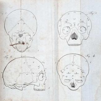 Galls Darstellung
